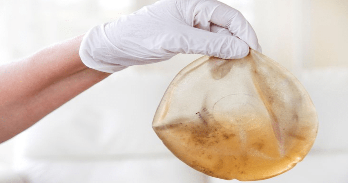 - Weten Wat Je Niet Weet Over Borstimplantaten